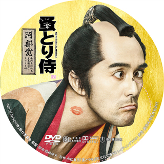 4 多発性骨髄腫の備忘録 なんじゃこりゃ